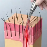 PRP Hair Therapy